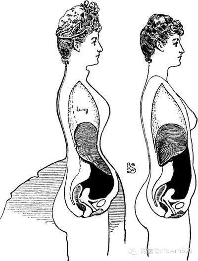 女人们<em>胸罩</em>成为你的健康杀手了吗这是一篇深